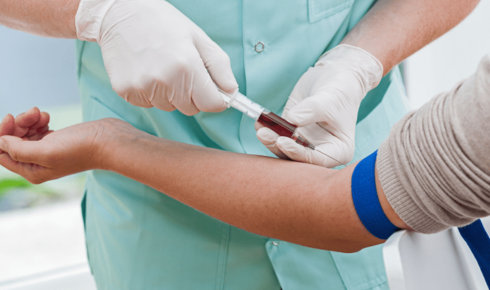 P Shot: A Revolutionary Solution for Men’s Health & Regeneration