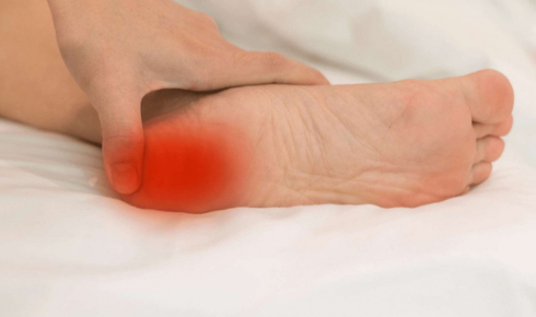Why Morning Heel Pain Often Indicates Chronic Plantar Fasciitis Rather than Simple Fatigue